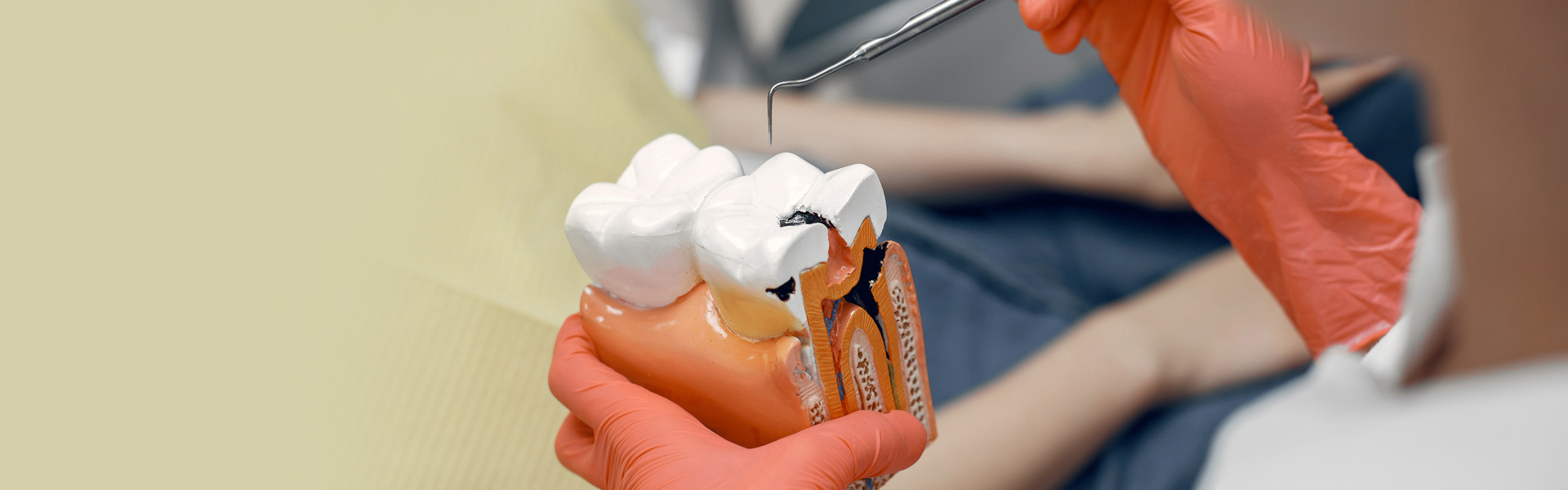 How Root Canal Treatment Saves Your Tooth and Prevents Extraction